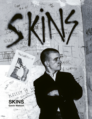 Skins: Gavin Watson - Gavin Watson
