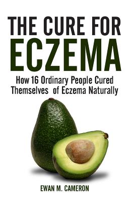 The Cure for Eczema - Ewan M. Cameron