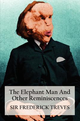 The Elephant Man and Other Reminiscences - Frederick Treves