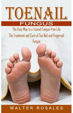 Toenail Fungus: The Easy Way to a Toenail Fungus-free Life (The Treatment and Cure of Toe Nail and Fingernail Fungus) - Walter Rosales