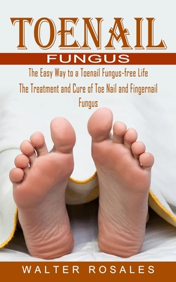 Toenail Fungus: The Easy Way to a Toenail Fungus-free Life (The Treatment and Cure of Toe Nail and Fingernail Fungus) - Walter Rosales