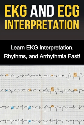 EKG and ECG Interpretation: Learn EKG Interpretation, Rhythms, and Arrhythmia Fast! - Alyssa Stone