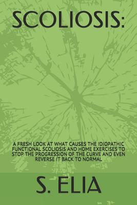 Scoliosis: : A Fresh Look at What Causes the Idiopathic Functional Scoliosis and Home Exercises to Stop the Progression of the Cu - S. Elia