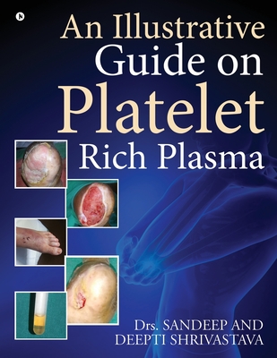An Illustrative Guide on Platelet Rich Plasma - Dr Sandeep