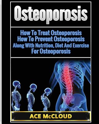 Osteoporosis: How To Treat Osteoporosis: How To Prevent Osteoporosis: Along With Nutrition, Diet And Exercise For Osteoporosis - Ace Mccloud