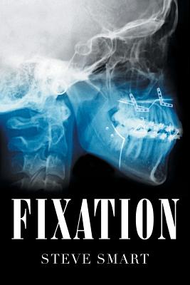 Fixation - Steve Smart