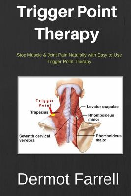 Trigger Point Therapy: Stop Muscle & Joint Pain Naturally with Easy to use Trigger Point Therapy - Dermot Farrell