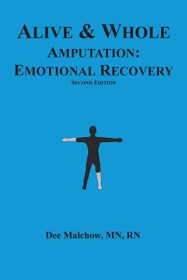 Alive & Whole Amputation: Emotional Recovery - Rn Dee Malchow Mn