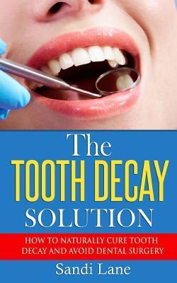 The Tooth Decay Solution: How to Naturally Cure Tooth Decay and Avoid Dental Surgery - Sandi Lane