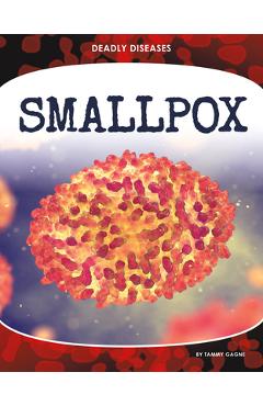 Smallpox
