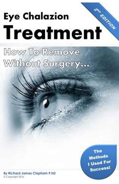 Poza produsului Eye Chalazion: How To Remove Without Surgery: My personal experience and the methods I used for success - Richard James Clapham Phd