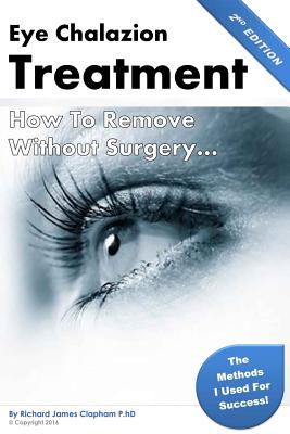 Eye Chalazion: How To Remove Without Surgery: My personal experience and the methods I used for success - Richard James Clapham Phd