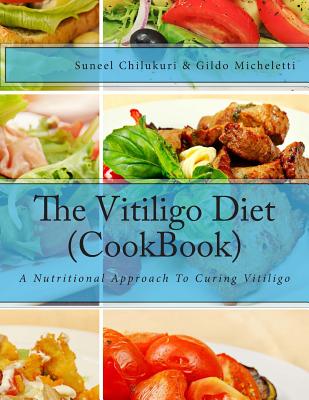 The Vitiligo Diet (CookBook): A Nutritional Approach To Curing Vitiligo - Gildo Micheletti