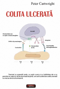 Colita ulcerata - Peter Cartwright