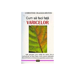 Coperta cărții 'Cum sa faci fata varicelor - Christine Craggs-Hinton'