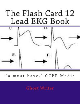 The Flash Card 12 Lead EKG - Ghost Writer