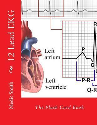 12 Lead EKG: The Flash Card Book - Medic Smith