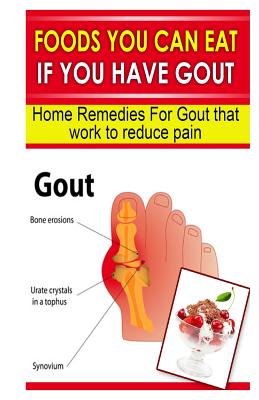 Foods You Can Eat If You Have Gout: Home Remedies for Gout That Work to Reduce Pain - Doc Goodman
