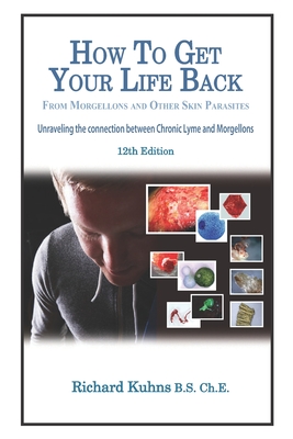 How to Get Your Life Back From Morgellons and Other Skin Parasites Limited Edit - Jonquelyn Kalmbah