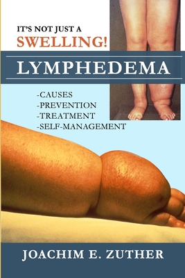 It's Not Just a Swelling! Lymphedema: Causes, Prevention, Treatment, Self-Management - Joachim Zuther