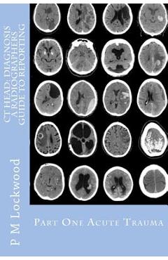Poza produsului CT Head: DIAGNOSIS A Radiographers Guide To Reporting Part 1 Acute Trauma: Part One Acute Trauma - P. M. Lockwood
