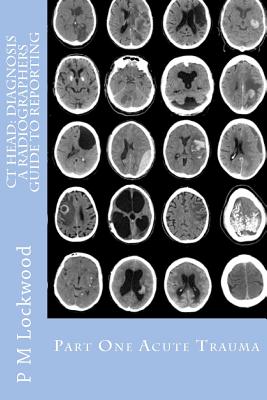CT Head: DIAGNOSIS A Radiographers Guide To Reporting Part 1 Acute Trauma: Part One Acute Trauma - P. M. Lockwood