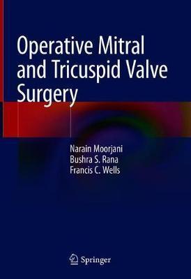 Operative Mitral and Tricuspid Valve Surgery - Narain Moorjani