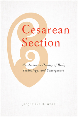 Cesarean Section: An American History of Risk, Technology, and Consequence - Jacqueline H. Wolf