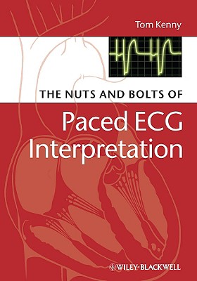 The Nuts and Bolts of Paced ECG Interpretation - Tom Kenny