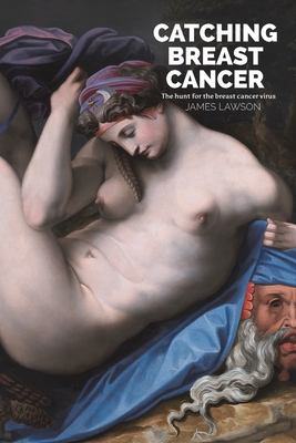 Catching Breast Cancer - James Lawson