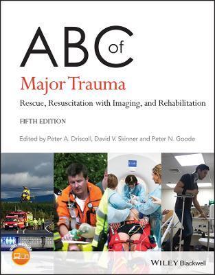 ABC of Major Trauma: Rescue, Resuscitation with Imaging, and Rehabilitation - Peter A. Driscoll