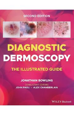 Diagnostic Dermoscopy: The Illustrated Guide - Jonathan Bowling