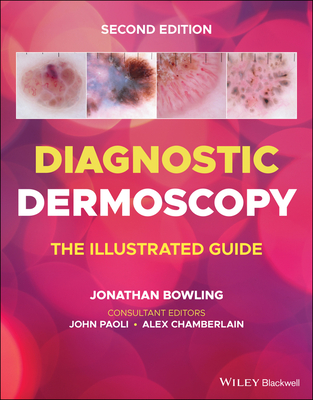 Diagnostic Dermoscopy: The Illustrated Guide - Jonathan Bowling