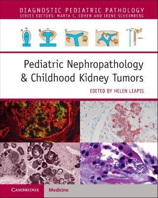 Pediatric Nephropathology & Childhood Kidney Tumors with Online Resource - Helen Liapis