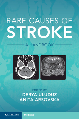 Rare Causes of Stroke: A Handbook - Derya Uluduz