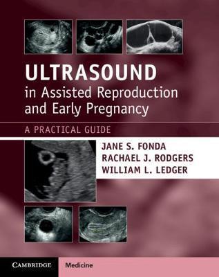 Ultrasound in Assisted Reproduction and Early Pregnancy: A Practical Guide - Jane S. Fonda