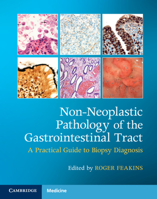 Non-Neoplastic Pathology of the Gastrointestinal Tract with Online Resource: A Practical Guide to Biopsy Diagnosis [With Access Code] - Roger M. Feakins