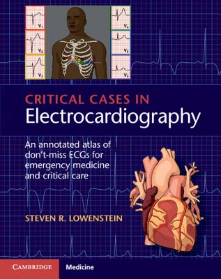 Critical Cases in Electrocardiography: An Annotated Atlas of Don't-Miss Ecgs for Emergency Medicine and Critical Care - Steven R. Lowenstein