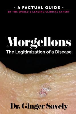 Morgellons: The legitimization of a disease: A Factual Guide by the World's Leading Clinical Expert - Ginger Savely