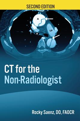 CT for the Non-Radiologist: The Essential CT Study Guide - Rocky Saenz