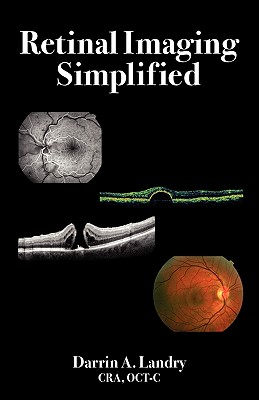 Retinal Imaging Simplified - Darrin A. Landry