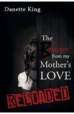 Coperta cărții 'The Bruises from my Mother's Love - Danette King'