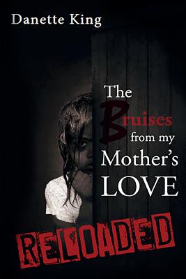 The Bruises from my Mother's Love - Danette King