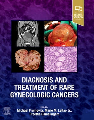 Diagnosis and Treatment of Rare Gynecologic Cancers - Michael Frumovitz