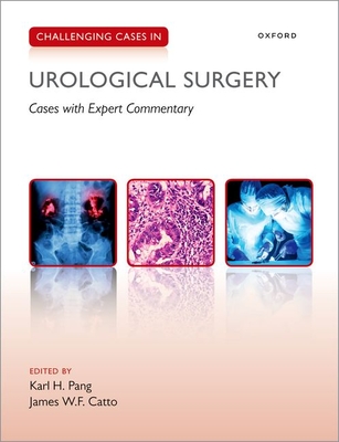 Challenging Cases in Urological Surgery - Karl Pang