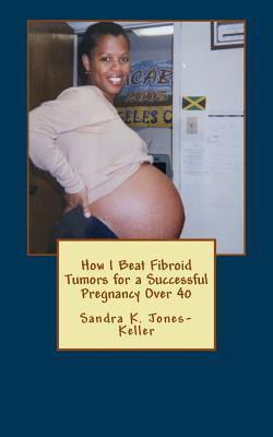 How I Beat Fibroid Tumors for a Successful Pregnancy Over 40 - Sandra K. Jones-keller