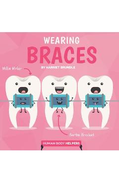 Wearing Braces