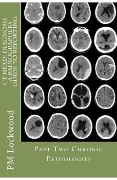 Poza produsului CT Head: DIAGNOSIS A Radiographers Guide To Reporting Part 2 Chronic Pathologies: Part 2 Chronic Pathologies - P. M. Lockwood