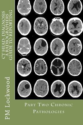 CT Head: DIAGNOSIS A Radiographers Guide To Reporting Part 2 Chronic Pathologies: Part 2 Chronic Pathologies - P. M. Lockwood