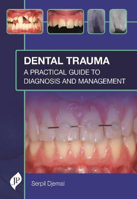 Dental Trauma: A Practical Guide to Diagnosis and Management - Serpil Djemal